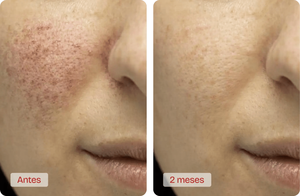 Serum Retinol Bioaqua