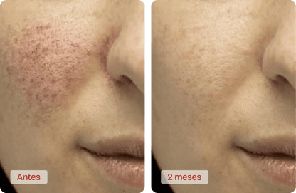 Serum Retinol Bioaqua